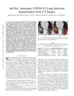 Inf-Net: Automatic COVID-19 Lung Infection Segmentation from CT Images
