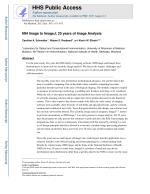NIH Image to ImageJ: 25 years of Image Analysis
