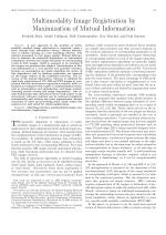Multimodality Image Registration by Maximization of Mutual Information