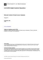 Molecular markers of breast cancer metastasis