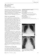 ABC of heart failure Investigation