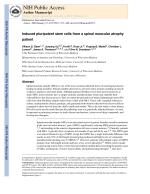 Induced pluripotent stem cells from a spinal muscular atrophy patient