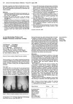A case illustrating Proteus and Klippel-Trenaunay syndrome overlap