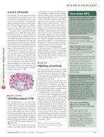 A new β cell model