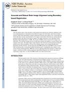 Accurate and Robust Brain Image Alignment using Boundary-based Registration