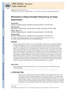 Minimization of Region-Scalable Fitting Energy for Image Segmentation