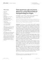 Oral squamous cell carcinoma detection using EfficientNet on histopathological images