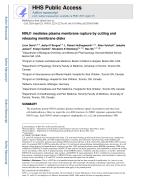 NINJ1 mediates plasma membrane rupture by cutting and releasing membrane disks