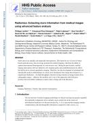 Radiomics: Extracting more information from medical images using advanced feature analysis