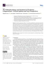 The Pathophysiology and Treatment of Pyoderma Gangrenosum—Current Options and New Perspectives