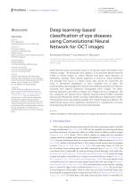 Deep learning-based classification of eye diseases using Convolutional Neural Network for OCT images