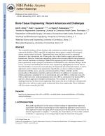 Bone Tissue Engineering: Recent Advances and Challenges