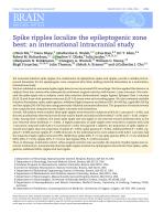Spike ripples localize the epileptogenic zone best: an international intracranial study