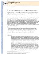 Fiji - an Open Source platform for biological image analysis